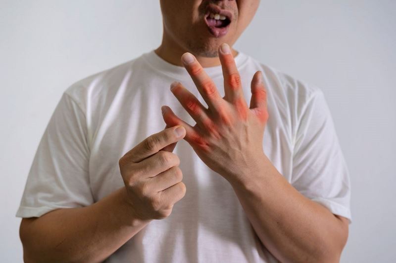 benh gout